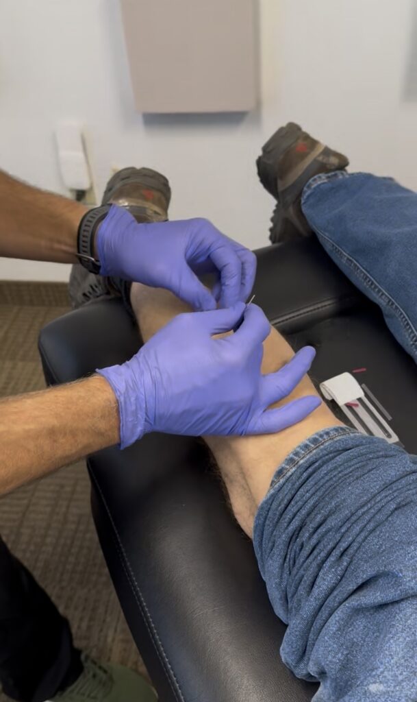 Dr. Jeff Manning performing dry needling on a patient at Manning Wellness Clinic in Dallas